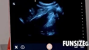 Ultra sound regions validation - dr wolf, austin