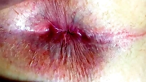 Ass plus anus closeup