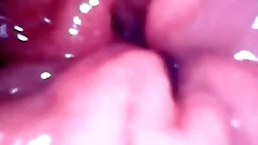 Median my anal pussy recommendation